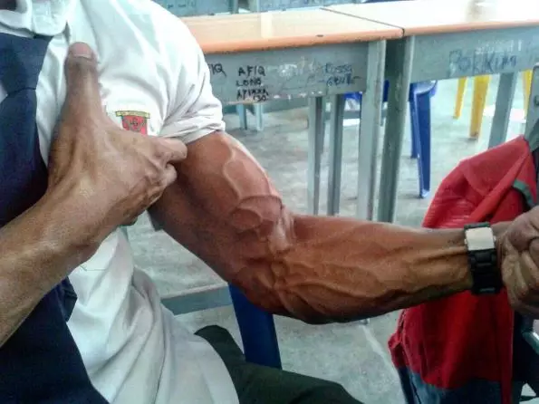 Remaja usia 17 tahun ini berbadan kekar bak binaragawan