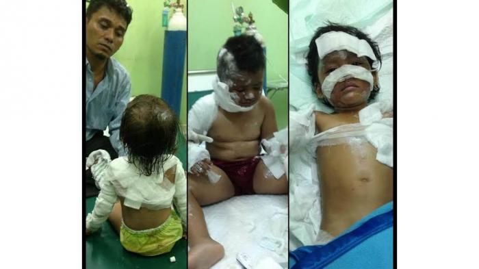Empat Balita Korban Bom di Gereja Alami Luka Bakar Sekujur Tubuh