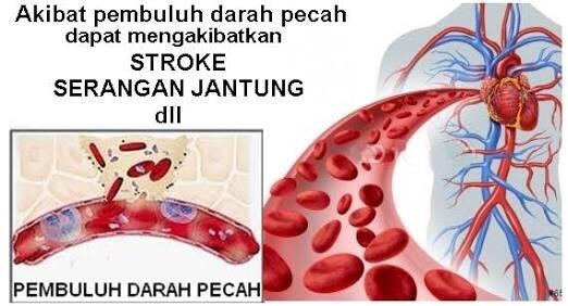 BAHAYA MEROKOK BAGI TUBUH