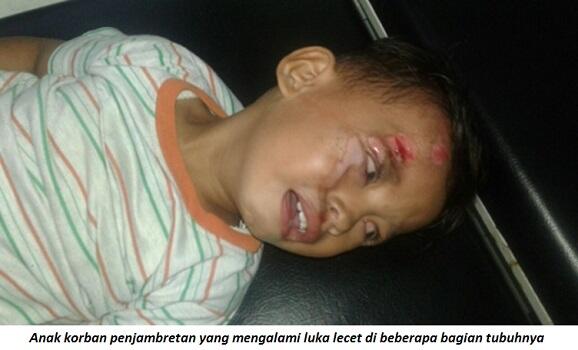 Si Jambret Beraksi di Siang Bolong, Istri dan Anak Anggota TNI Jadi Korban ..