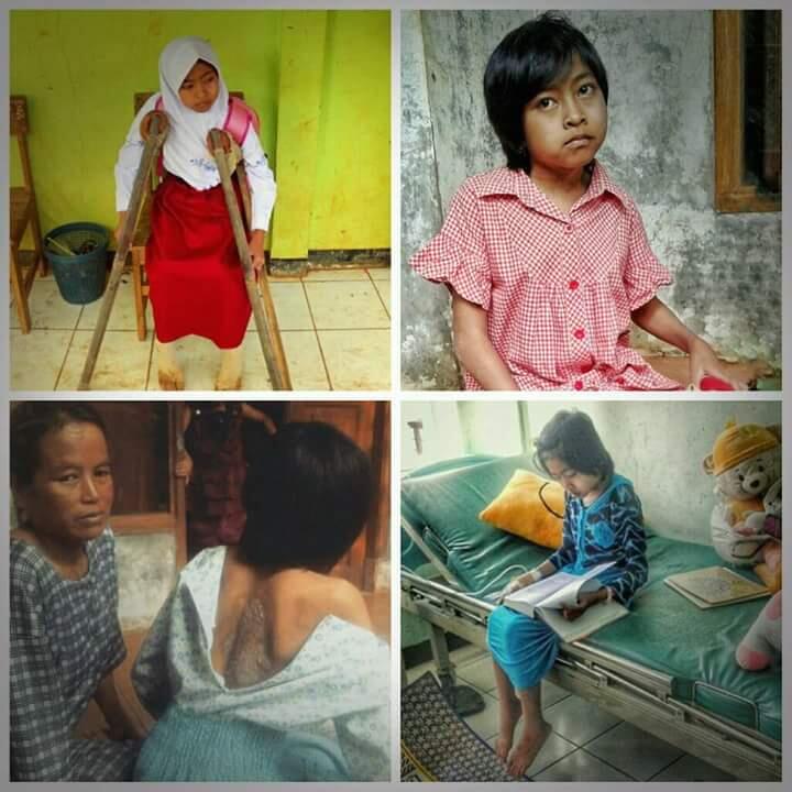 Bantu Ratih (penderita lumpuh dan paru paru yg harus berobat jalan selama 6 bulan )