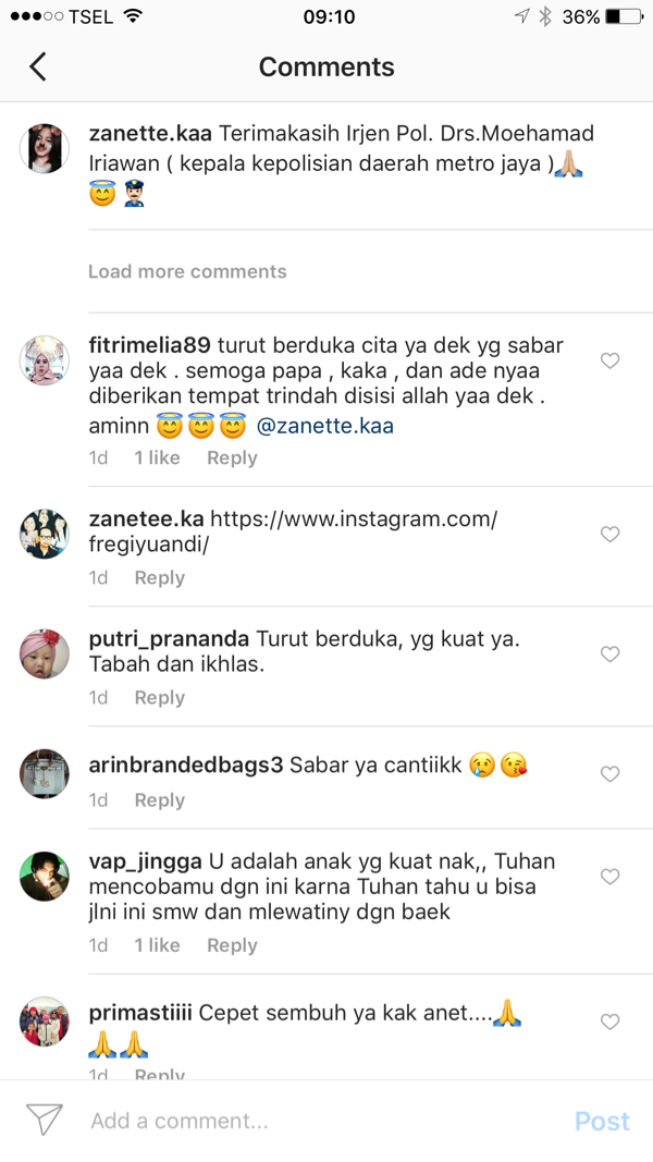 Kapolda Metro Jaya Jenguk Zanette sambil usap rambut dan Cium kening