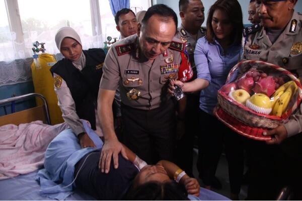 Kapolda Metro Jaya Jenguk Zanette sambil usap rambut dan Cium kening