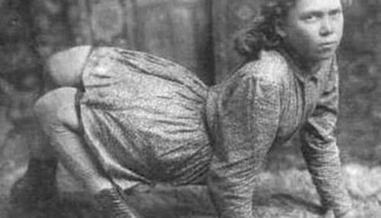 10 Wanita Pemain Sirkus ini Memiliki Tubuh yang Sangat Langka (REAL)