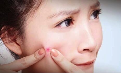 5 Fungsi Lain Aspirin Selain Meredakan Sakit Kepala