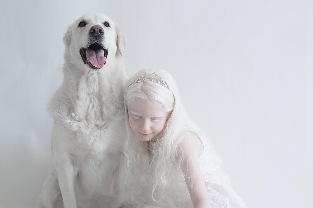 Beberapa Fakta Tentang Albino dan Potret Cantik dari Penderita Albino