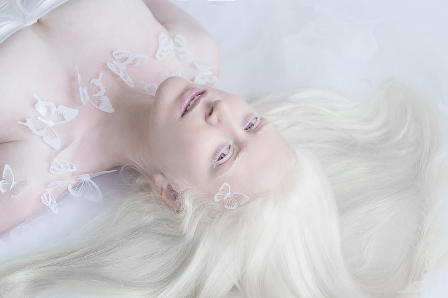 Beberapa Fakta Tentang Albino dan Potret Cantik dari Penderita Albino