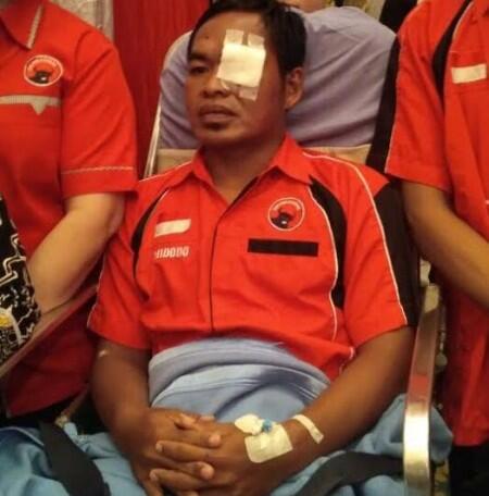 Korban Pengeroyokan bakal Dapat Santunan di HUT PDI-P