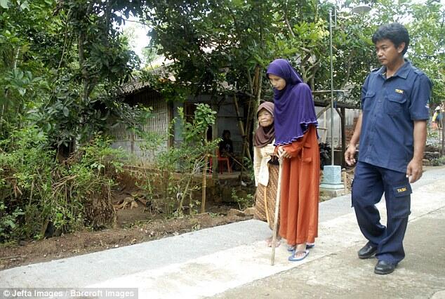 Mengenal Penyakit Tulang Bambu yang Diidap 'Manusia Kayu' dari Sragen