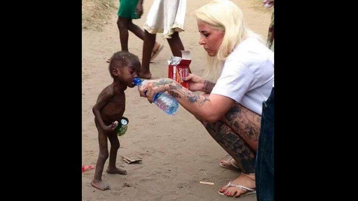 Bocah Ini Dulu Hebohkan Dunia, Kini Fisiknya Berubah dan Mulai Bersekolah