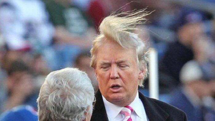 Terlihat Lebat dan Pirang, Rambut Donald Trump Sebenarnya Botak