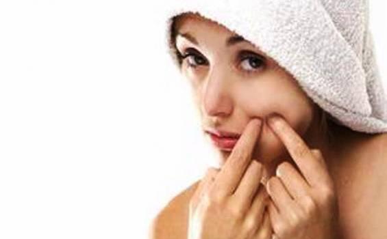 Kebiasaan Buruk Ini Picu Munculnya Jerawat Pada Wajah