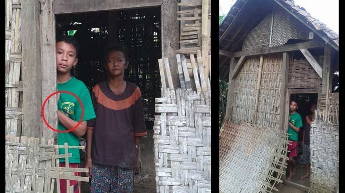 Kisah Bocah Asal Trenggalek Ini Bikin Bonek Haru, Mereka Bersatu Lalu Lakukan Ini