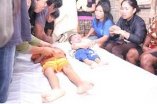 Pascaevakuasi, Balita Eks Yayasan Tunas Bangsa Kondisi Kesehatannya Memprihatinkan