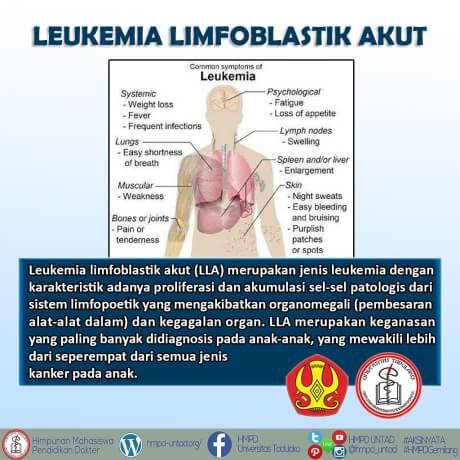 HMPD UNTAD - Leukemia limfoblastik akut