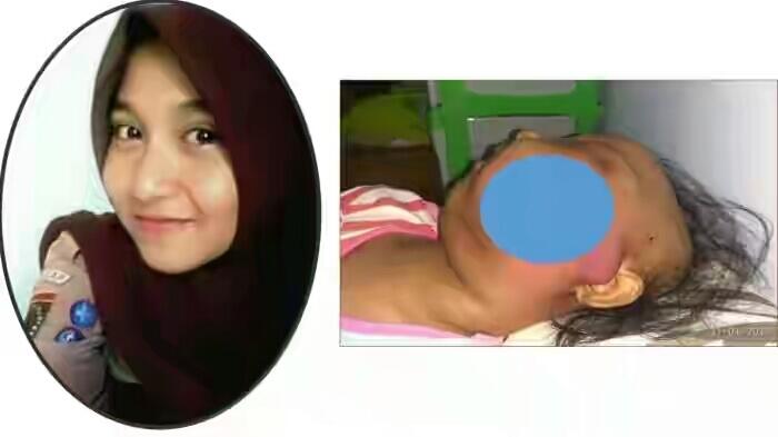 Gadis Cantik Asal Cilacap Itupun Pergi untuk Selamanya