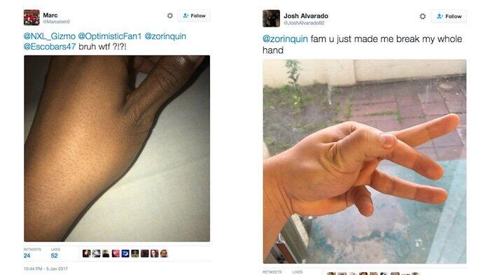 Warning! Tren Patahkan Jempol Jd Viral Dan Memakan Banyak Korban