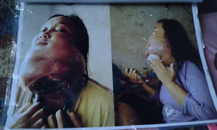 Ane Bantu Share : need help 
