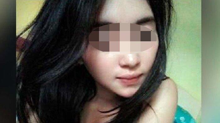 Pemandu Lagu Disiram Air Keras, Orangtua: Aji Minta Balikan Disertai Ancaman