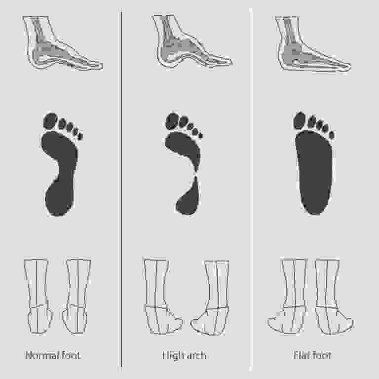 Jenis Sepatu Lari Seperti Apa yang Cocok Untukmu? Ini Panduan Memilihnya