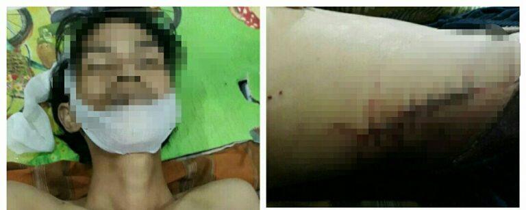 Pembunuhan di Kalsel : Gara-gara Uang 50 Ribu Nyawa Melayang