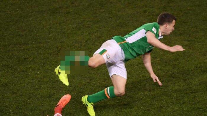 FIFA Tanggung Semua Biaya Pemulihan Seamus Coleman