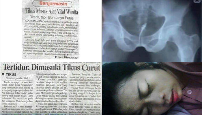 Suami Terkejut Saat Malam Pertama Lihat Ada Ekor Menggantung Di Alat Kelamin Istri?