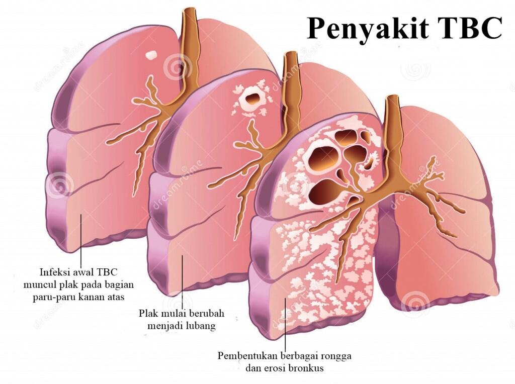 6 Khasiat Akar Bambu Kuning Untuk Kesehatan
