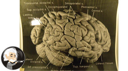 Fakta Terbaru Isi Otak A. Einstein (Penjelasan 14 Foto yang Saat Ini Dirahasiakan)