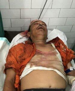 Perwira Polisi Dibacoki Saat Tangkap Bandar Sabu di Medan Denai
