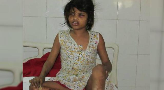 Di Antara Kera, Bocah Mowgli Ditemukan di Hutan India