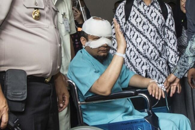 Novel Dirawat di Singapura Sampai Benar-benar Sembuh