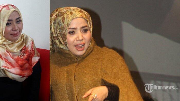 Mantan Istri Nassar Tampil Lebih Langsing, Berat Badan Turun Hingga 10 Kg
