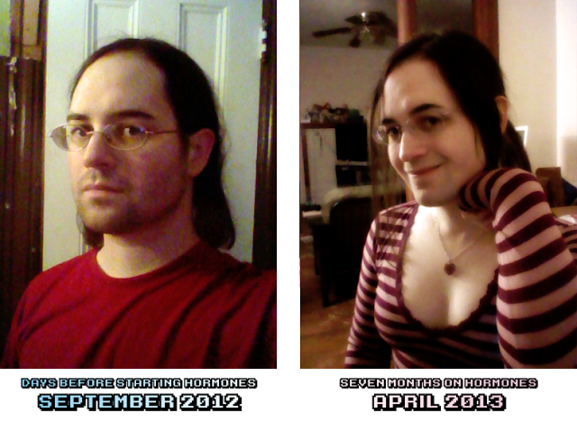 20 Foto Before After Perubahan Transgender Paling Ekstrim