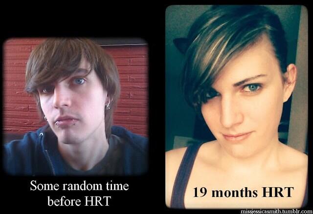 20 Foto Before After Perubahan Transgender Paling Ekstrim