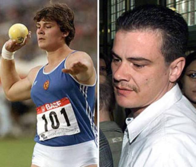 20 Foto Before After Perubahan Transgender Paling Ekstrim