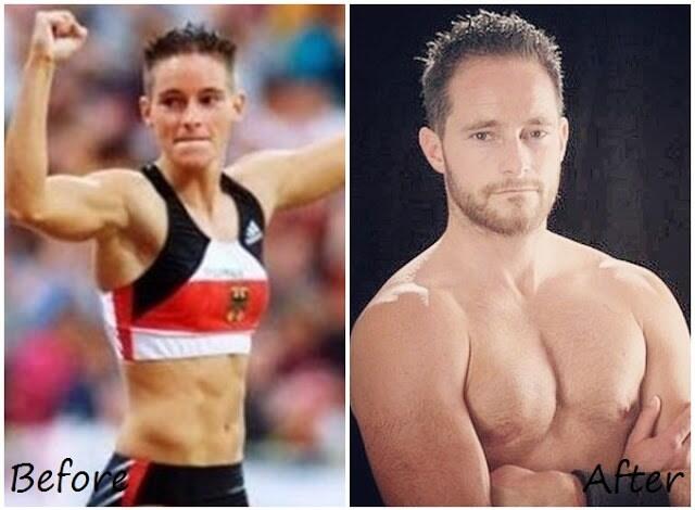 20 Foto Before After Perubahan Transgender Paling Ekstrim