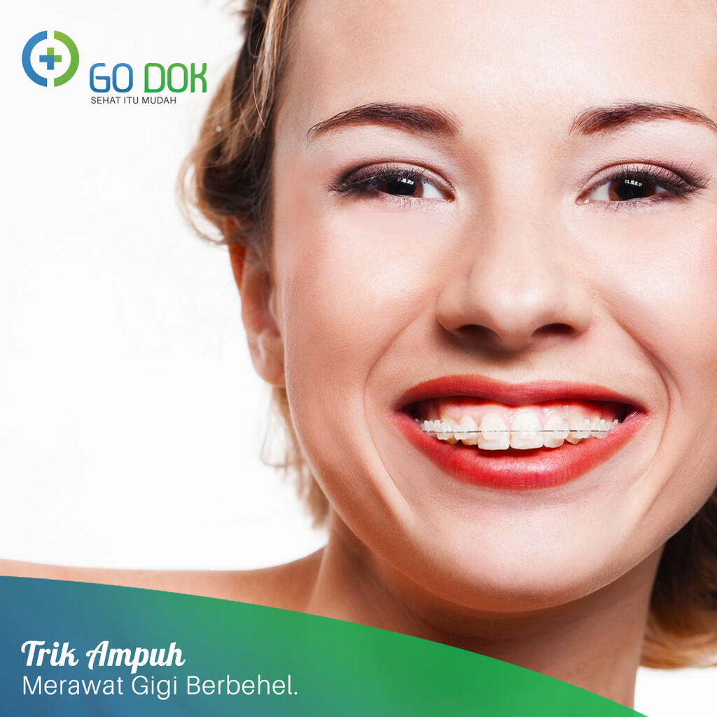 Pengen Pake Behel? Simak Dulu Cara Merawatnya di Sini!