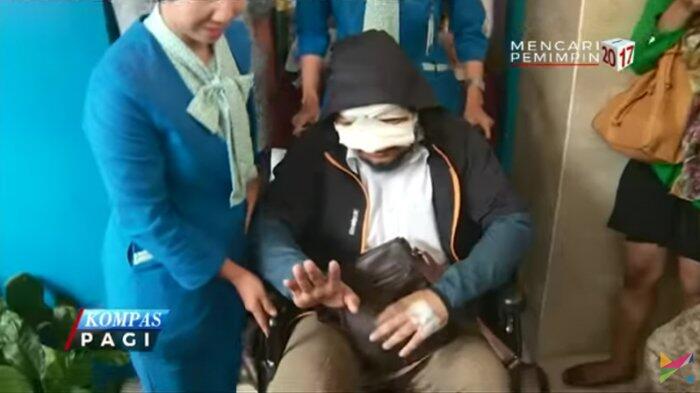 KPK: Dokter Indonesia Bisa Kok Sembuhkan Novel, Tapi Obatnya Sulit Didapat