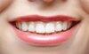 10 Bentuk Bibir dan Karakteristik Pemiliknya, Kamu yang Mana?