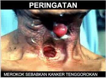 Tahukah Siapa Pemilik Leher pada Bungkus Rokok Ini?