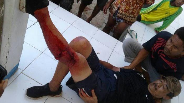 Wisatawan Singapura yang Digigit Komodo Dua Kali Masuk Taman Tanpa Beli Karcis Masuk