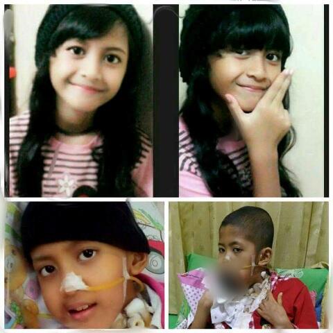Bocah Tania Berjuang Melawan Kanker Ganas