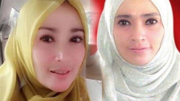 Inafis Pastikan Foto Bugil Firza Husein Bukan Rekayasa Kaskus