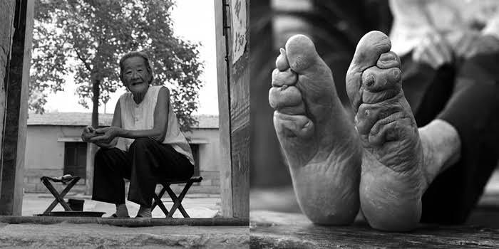 Terungkap, Alasan Tradisi Membonsai Kaki Gadis di Tiongkok