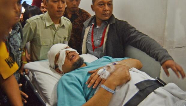 57 Hari Kasus Novel Baswedan, Lenyapnya Sidik Jari Mencurigakan