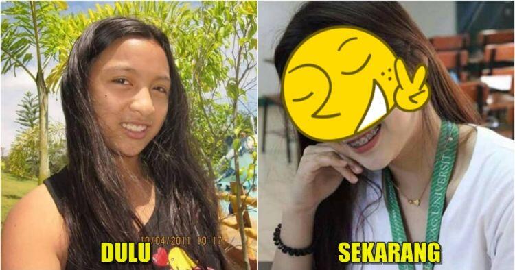 Beranjak dewasa, perubahan fisik gadis ini dijamin bikin pangling(jomblo inside)