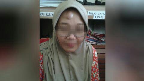 Parah Gan! Pelajar ini Pukul Guru Perempuan Sampai Benjol karena Tidak Naik Kelas