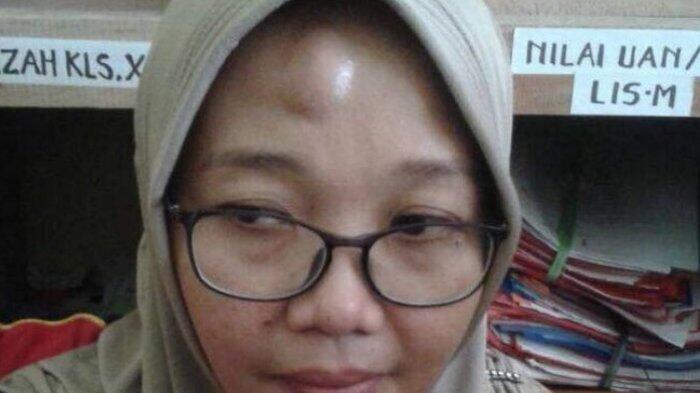 Wajah Guru Perempuan Ini Muncul Benjolan Setelah Diamuk Muridnya yang Tak Naik Kelas