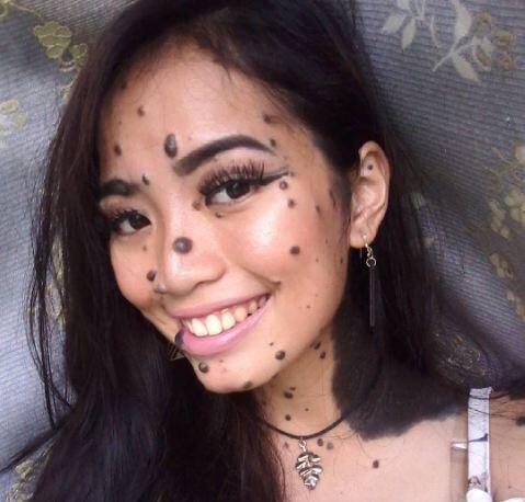 Masuk Kontes Kecantikan, Tubuh Perempuan Ini Beda dari yang Lain